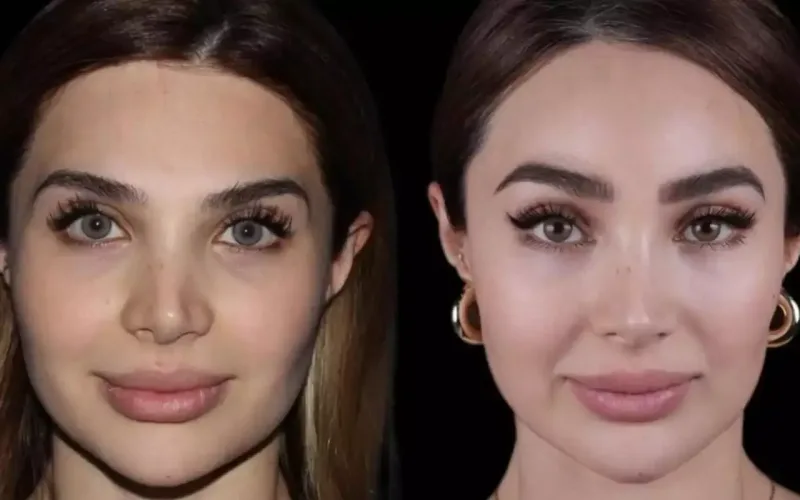 Ülviyyənin iki illik dəyişimi