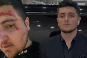 Azərbaycanlı videoqraf klip çəkilişində yıxıldı