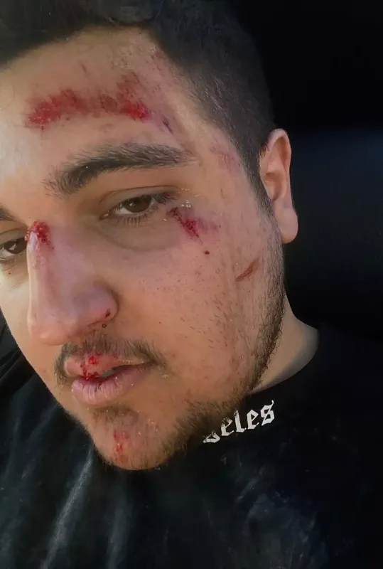 Azərbaycanlı videoqraf klip çəkilişində yıxıldı