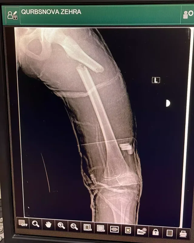 Azərbaycanlı müğənninin ailəsində faciə!