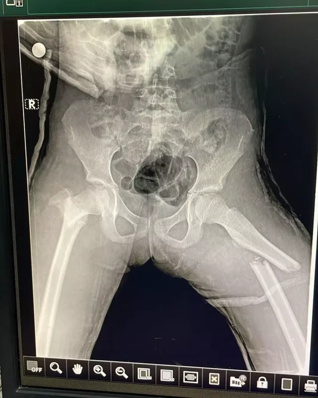 Azərbaycanlı müğənninin ailəsində faciə!