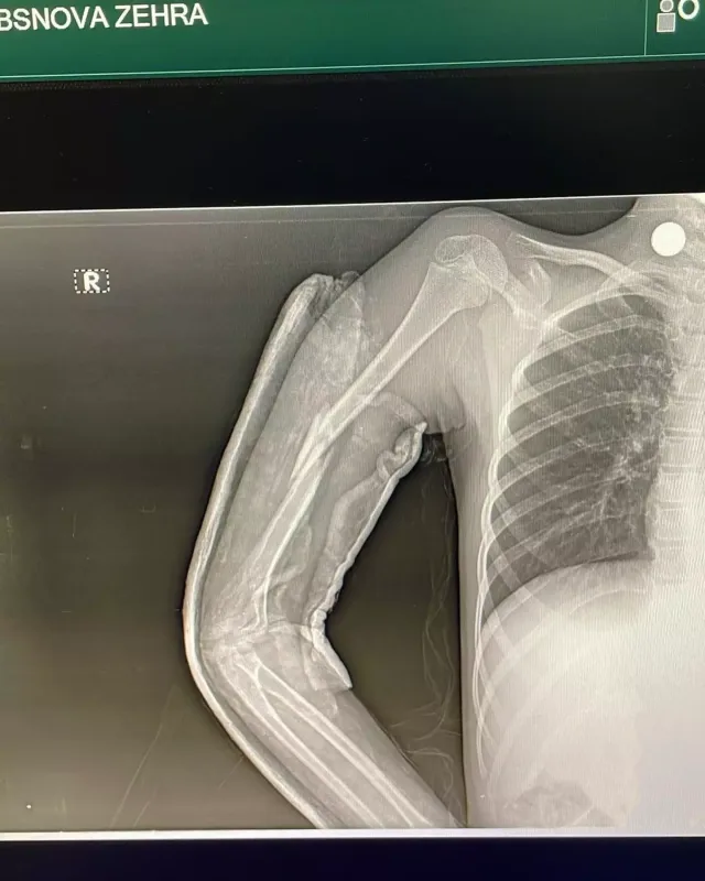 Azərbaycanlı müğənninin ailəsində faciə!