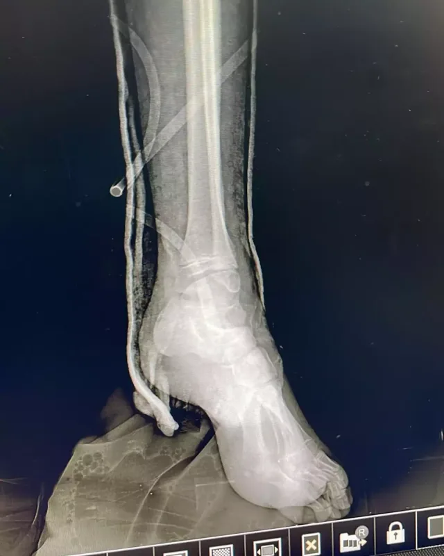 Azərbaycanlı müğənninin ailəsində faciə!