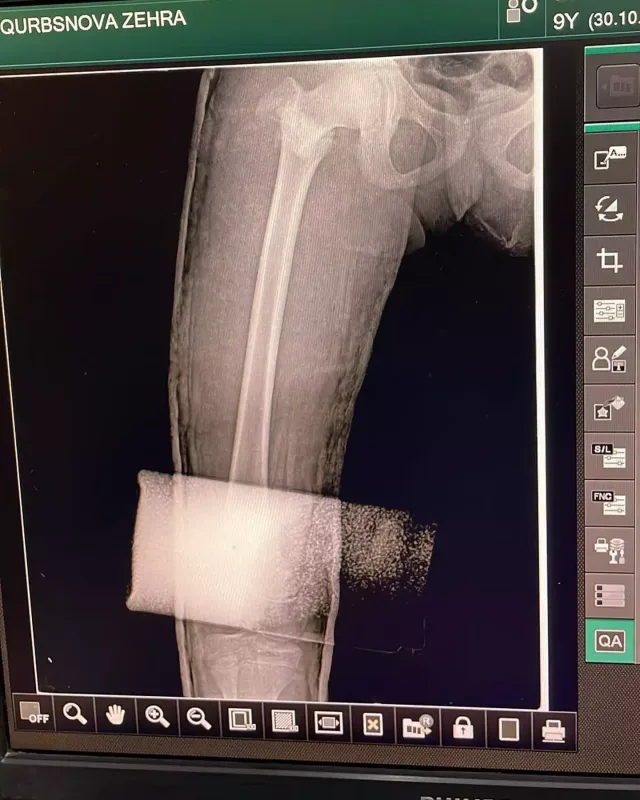 Azərbaycanlı müğənninin ailəsində faciə!