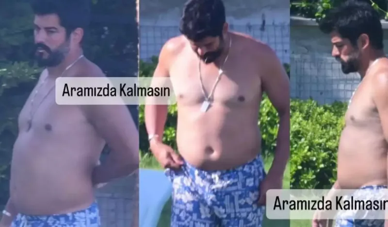 Burak Özçivitin artıq çəkiləri müzakirə yaratdı