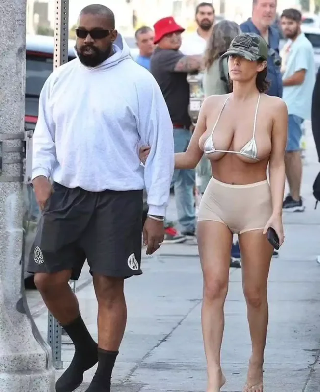 Bianka sinə əməliyyatı olunub?