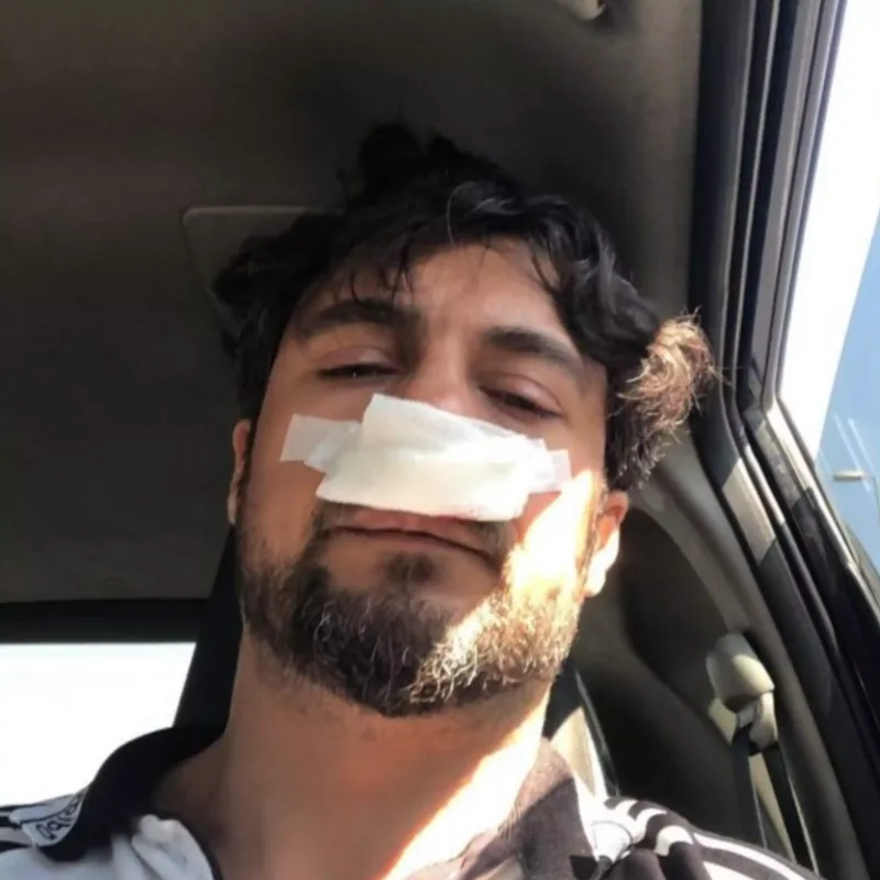 Rüstəm Cəbrayılov əməliyyat olundu