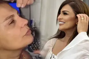 Aynur Dadaşova estetikdən sonra