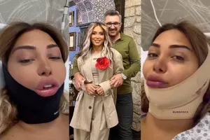 Əri Çinarəni əməliyyat etdi