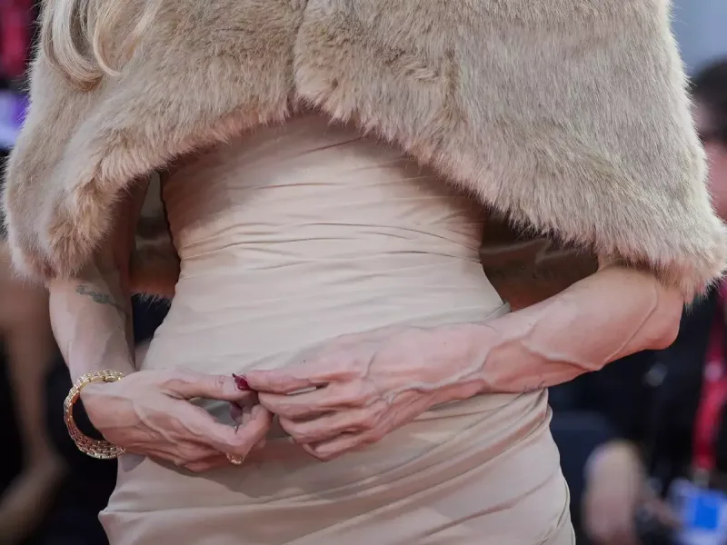 Ancelina Colinin əllərinə nə olub?