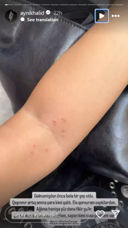 Tətilindən sonra səhhətində problem yarandı