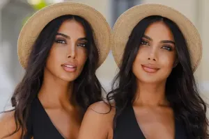 “Azərbaycan kişisinə bu çıxışı yaraşdıra bilmirəm”