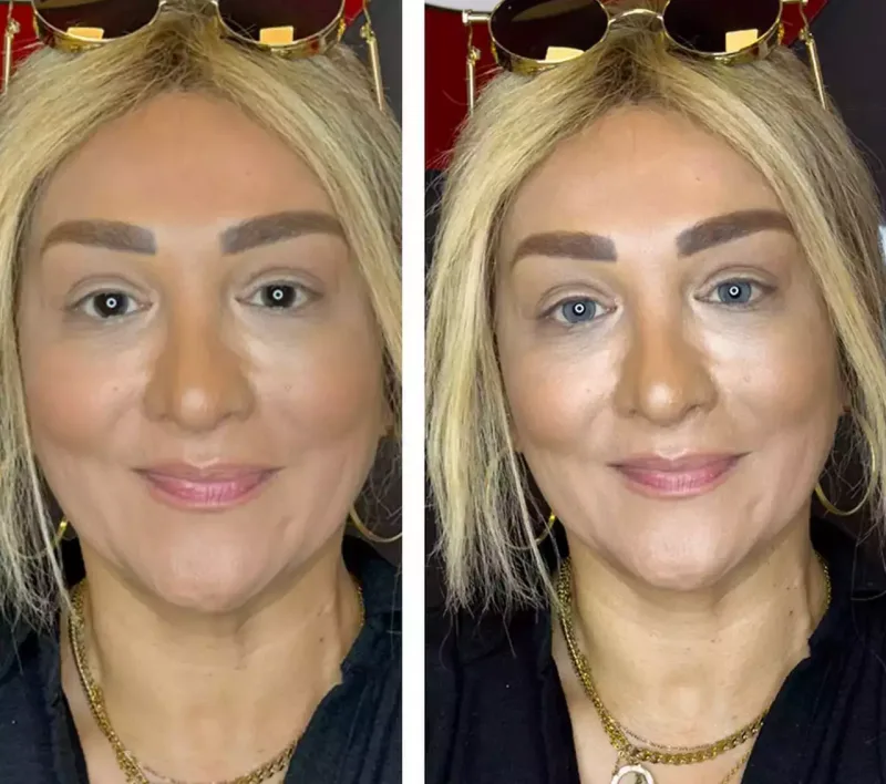 “Bu əməliyyat böyük riskdir”