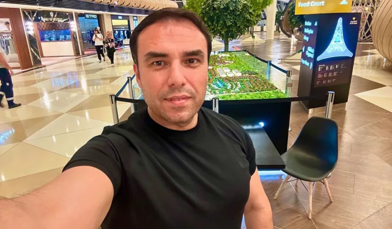 İlkin Əhmədov saç əkdirdi