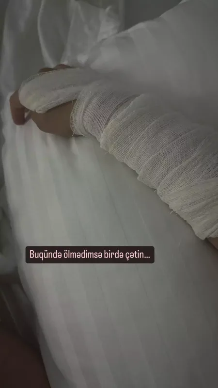 Başından və qolundan zədə alan aparıcıdan açıqlama!