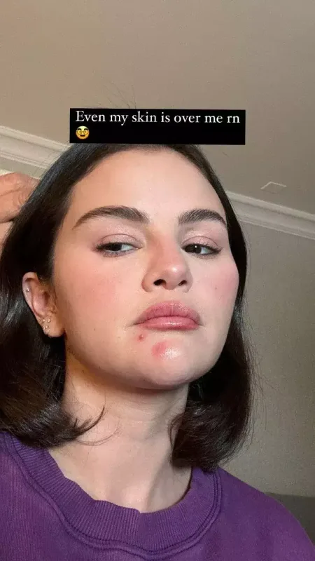 Selena makiyajsız halı ilə təəccübləndirdi