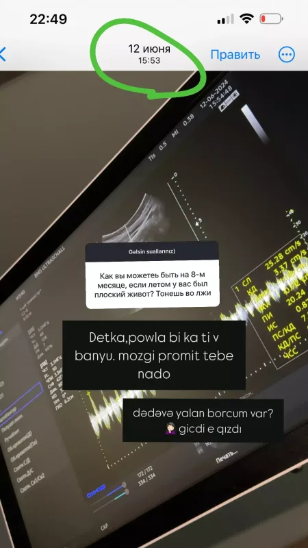 “Nə edim ki, qarnım gec çıxıb” - Hamiləliyi tənqid olunan Razi