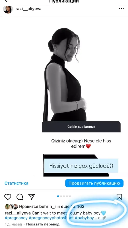 “Nə edim ki, qarnım gec çıxıb” - Hamiləliyi tənqid olunan Razi