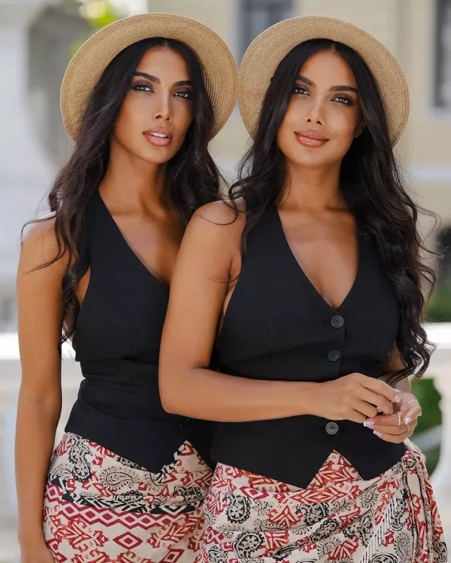 “Buna görə burnumu 3 dəfə əməliyyat etdirdim”