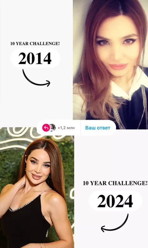 Ülviyyə estetikdən öncə - Foto