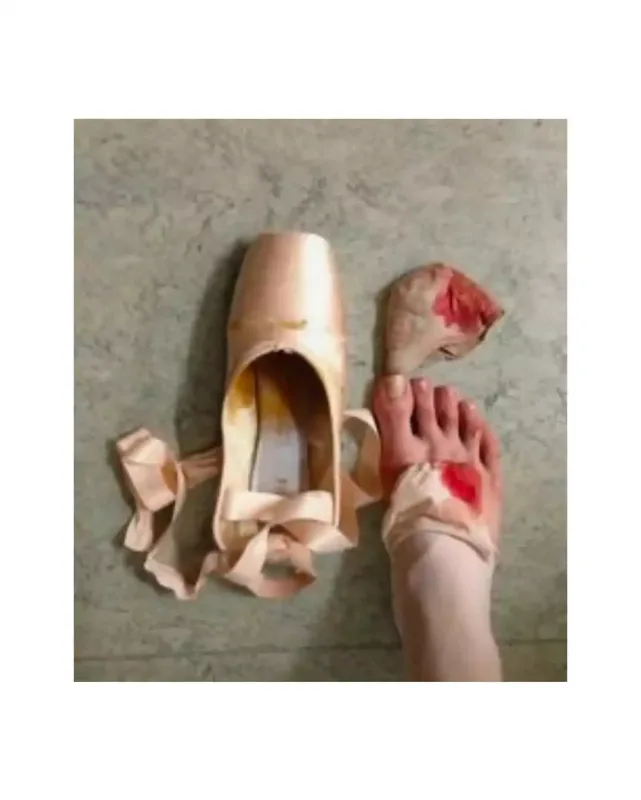 Britni yarıçılpaq rəqslərinin dəhşətli nəticələrini göstərdi