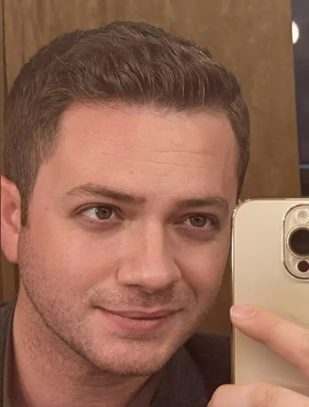 Nadir yenidən görünüşünü dəyişdi