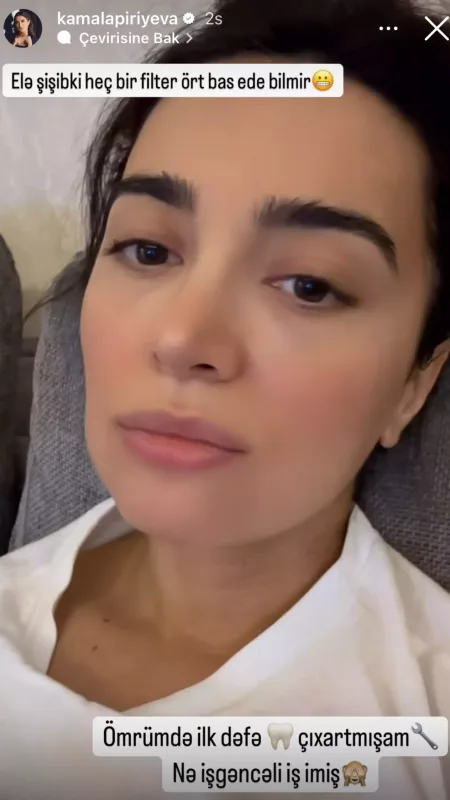 Kəmalənin səhhətində problem yarandı