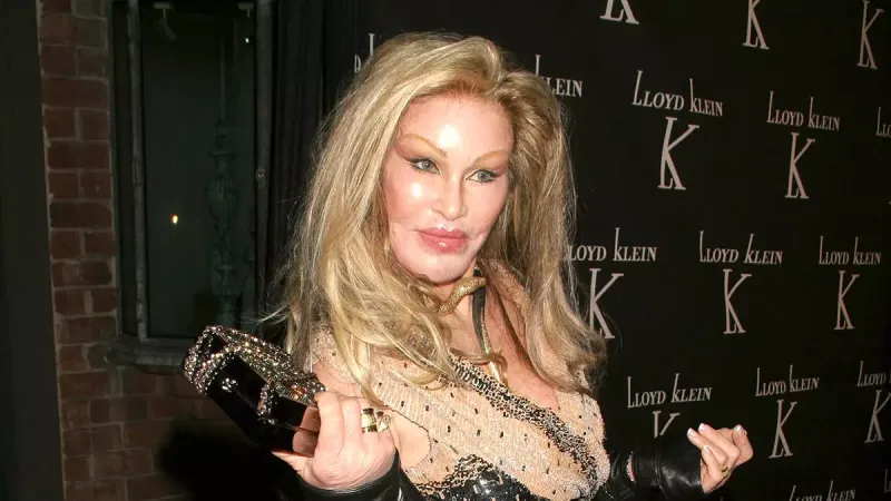 Plastik əməliyyatlar etdirdiyini boynuna almadı