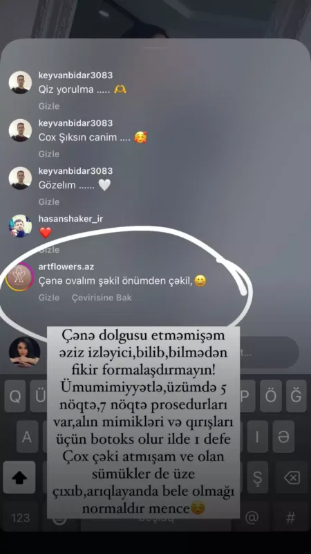 Vüsalədən estetik iddiasına cavab