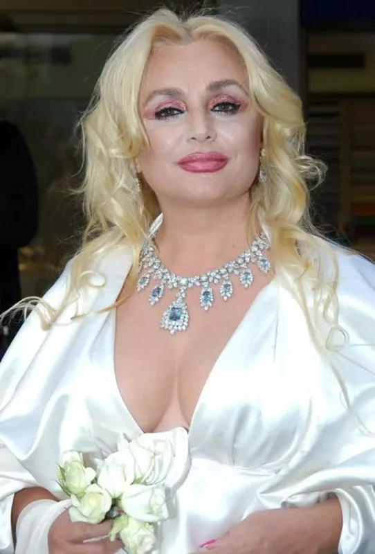 Banu Alkanın beyninə qan sızdı