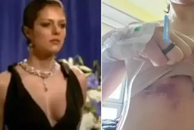 Məşhur modelin döşləri çürüdü