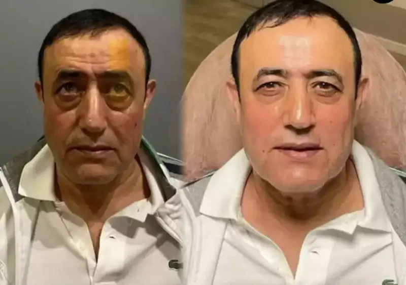 Məşhur müğənniyə göyərçin nəcisi yedizdiriblər?