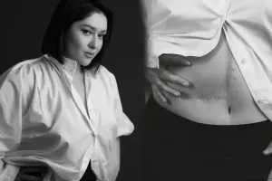 Nərmin əməliyyat izini göstərdi