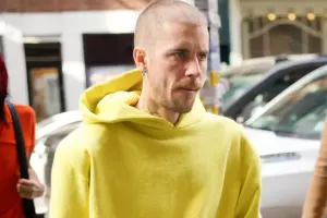 Castinin saçlarını keçəl etməsi müzakirə yaratdı