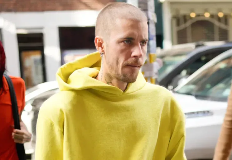 Castinin saçlarını keçəl etməsi müzakirə yaratdı