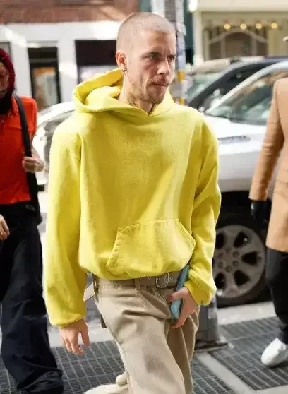 Castinin saçlarını keçəl etməsi müzakirə yaratdı