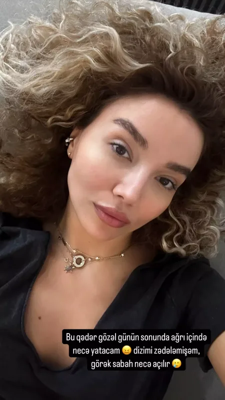 Üzel xəsarət aldı