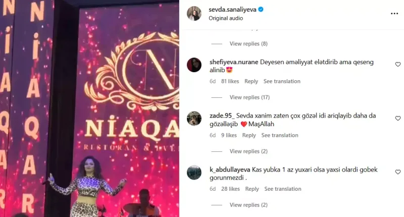 İzləyicilər Sevdanın pəhrizlə arıqlamasına inanmadılar
