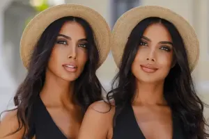 Plastik əməliyyatdan öncəki hallarını paylaşdılar