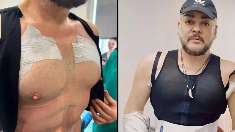 Kirkorov bu yolla 30 kiloqram arıqlayıb