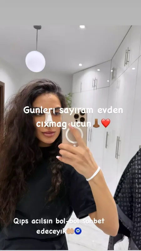 Burnu qırılan Sevinc əməliyyatdan sonra - FOTO