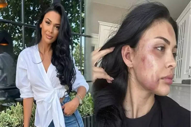 Razini döyməkdə təqsirləndirilən Ziyaya hökm oxundu