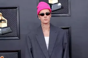 Castinin başına saç əkdirdiyi üzə çıxdı