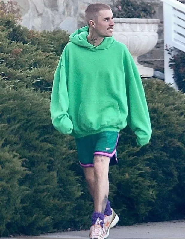 Castinin başına saç əkdirdiyi üzə çıxdı