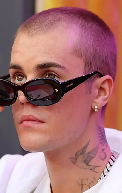 Castinin başına saç əkdirdiyi üzə çıxdı