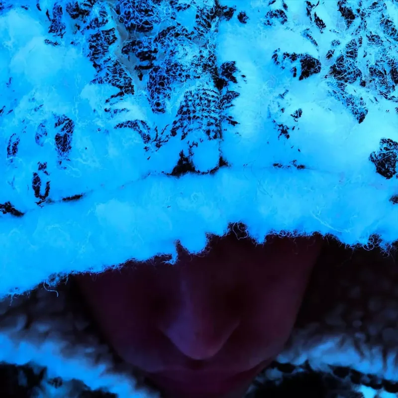 Biber psixi probleminin olduğunu etiraf etdi