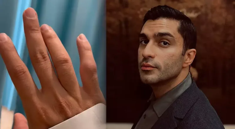 İbrahim Çingiz xəstəxanaya yerləşdirildi