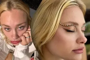 Dubayda xəsarət alan modeldən xəbər var!