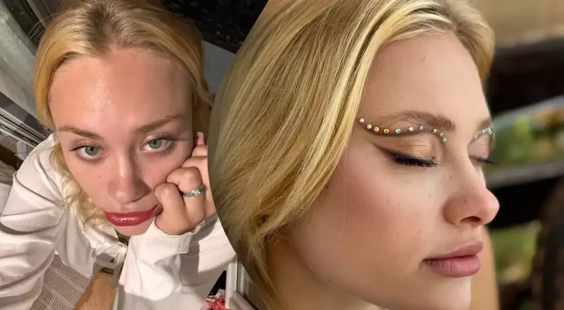 Dubayda xəsarət alan modeldən xəbər var!