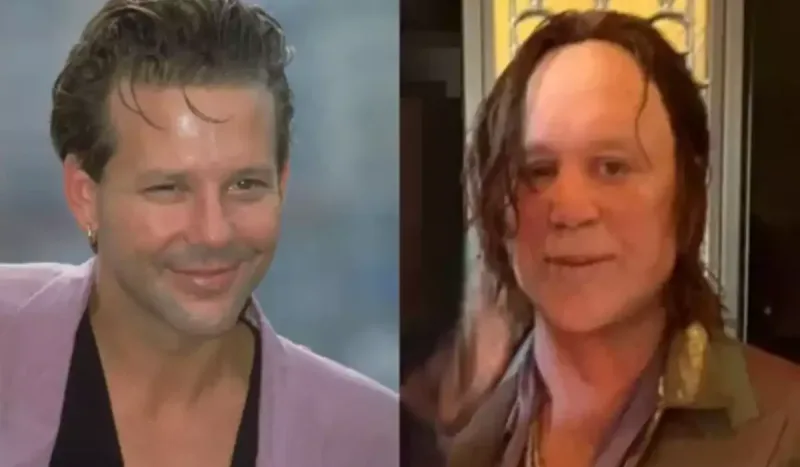 Plastik əməliyyatlarla tanınmaz hala düşən Hollivud ulduzu - Foto